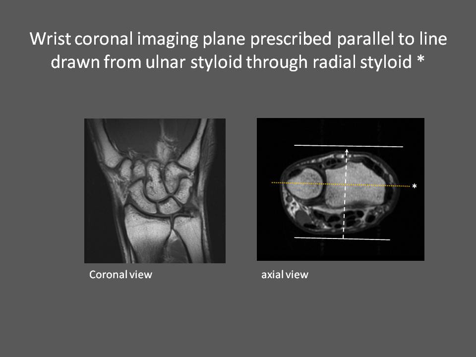 MRI Wrist How we do it How is MRI Wrist done at Mater Dei Hospital